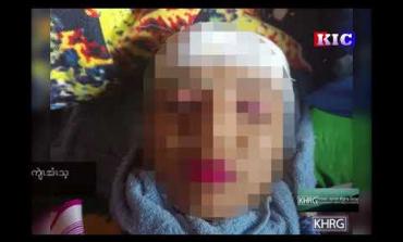 Embedded thumbnail for A 17 years old girl killed and three other villagers injured by the SAC indiscriminate shelling in Htee Moo Hta village, Noh Hpoh village tract, Kaw T’Ree Township, Dooplaya District, March 2022 (KHRG)